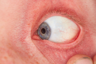 HD Eyes Sam Atkins eye eye texture eyelash iris pupil…